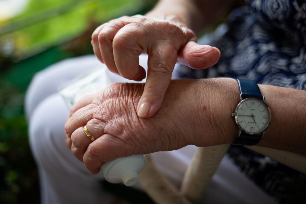 Por que surgem manchas na pele de idosos