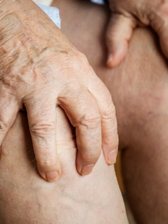 Conheça fatores de risco para artrose