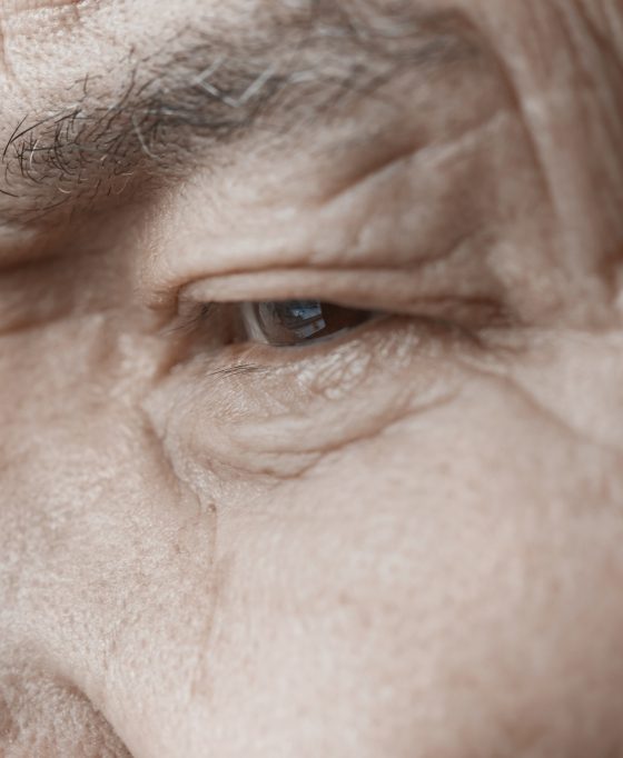 Residencial Jardim Isabel alerta para cuidados com os olhos em idosos